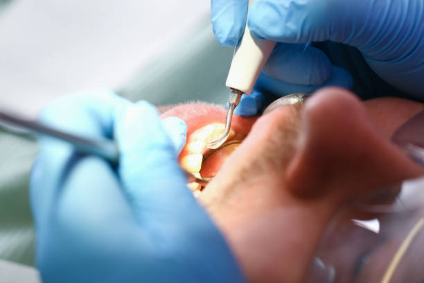 Best Emergency Dental Care for Sports Injuries in Norridge, IL