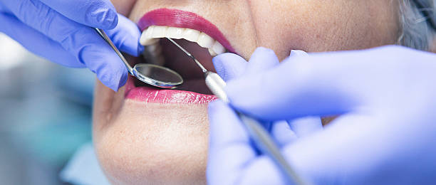 Best Broken or Chipped Tooth Repair in Norridge, IL